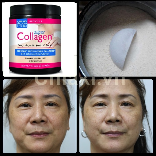 Uống Collagen Vào Thời Điểm Nào Để Đạt Kết Quả Tốt Nhất?