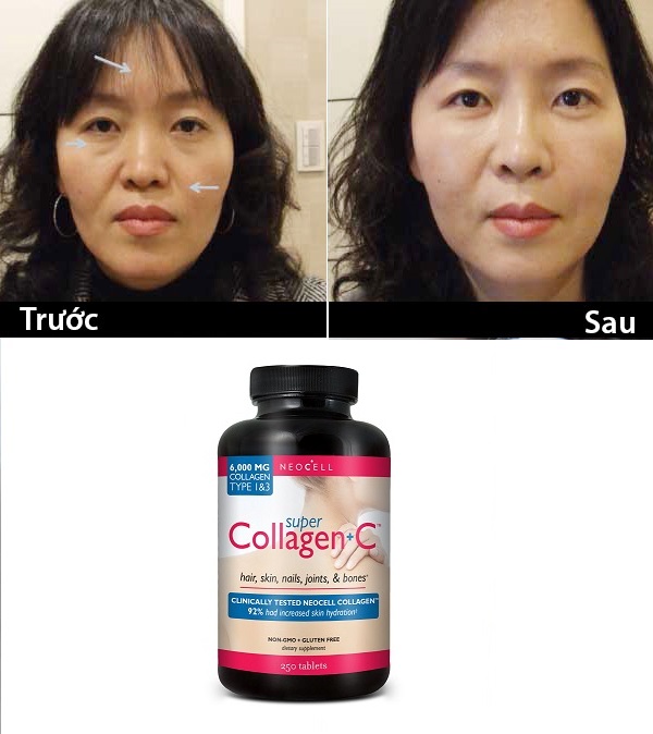 Uống Collagen Vào Thời Điểm Nào Để Đạt Kết Quả Tốt Nhất?