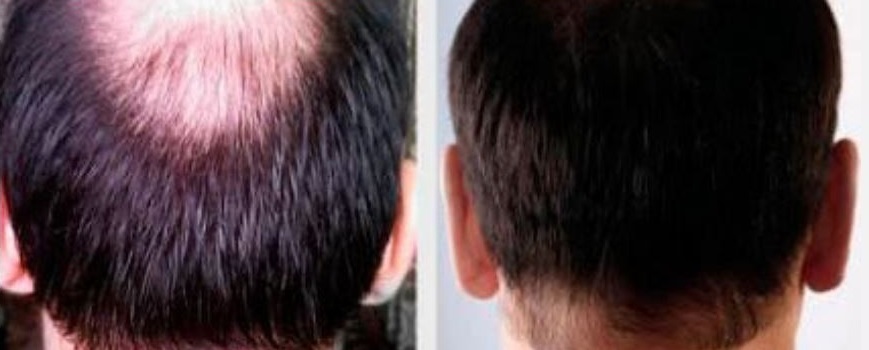 Viên uống Strong Hair hỗ trợ chống rụng tóc, cải thiện tóc yếu - Sản phẩm thiên nhiên từ Học viện Quân Y, 30 viên