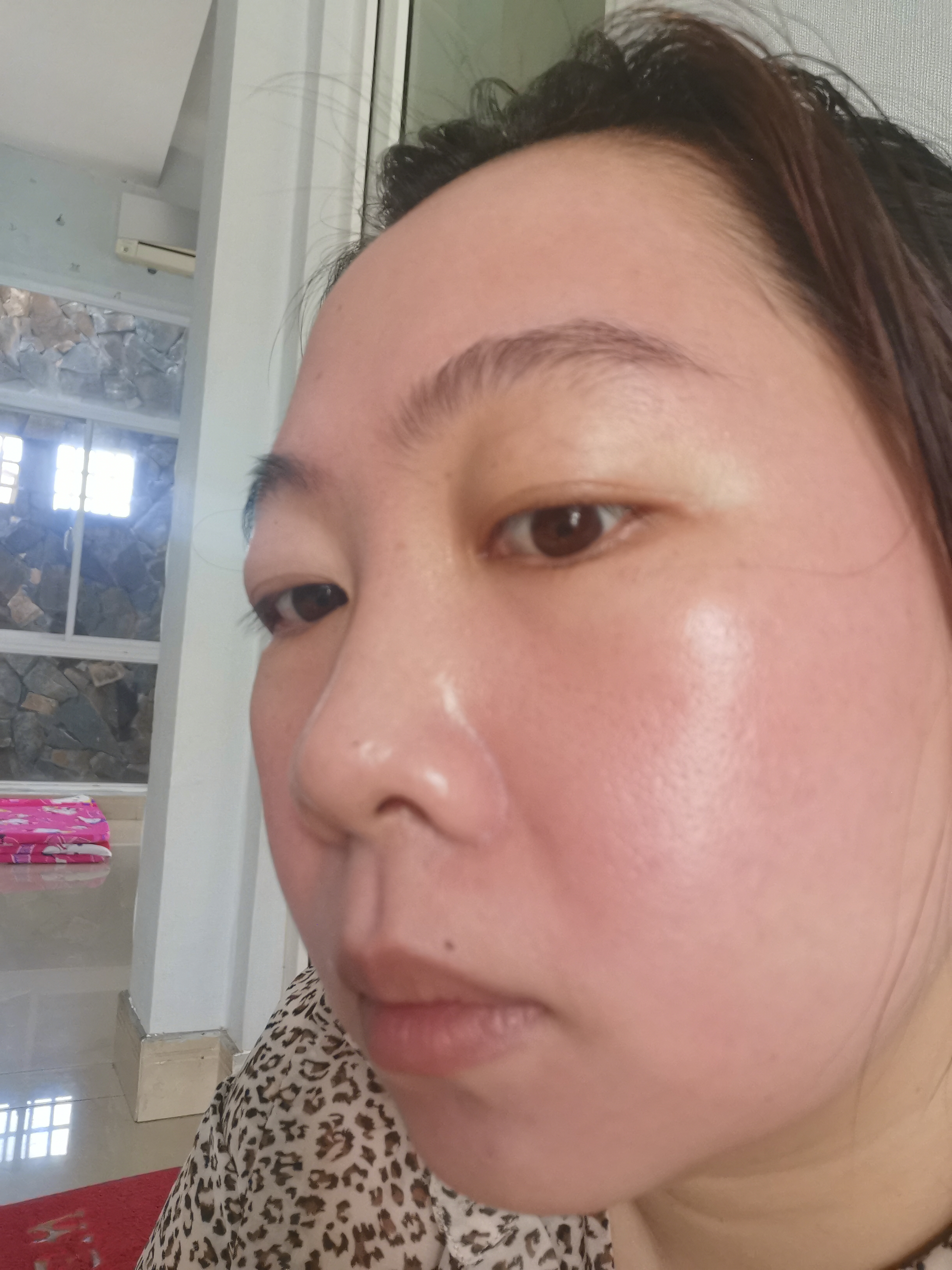 Kem Trị Nám Obagi Nu-Derm Clear số 3 - Hỗ Trợ Cải Thiện Da Thâm Nám Cho Mọi Loại Da - Chăm Sóc Da Chuyên Sâu, Tái Tạo Sắc Tố Da