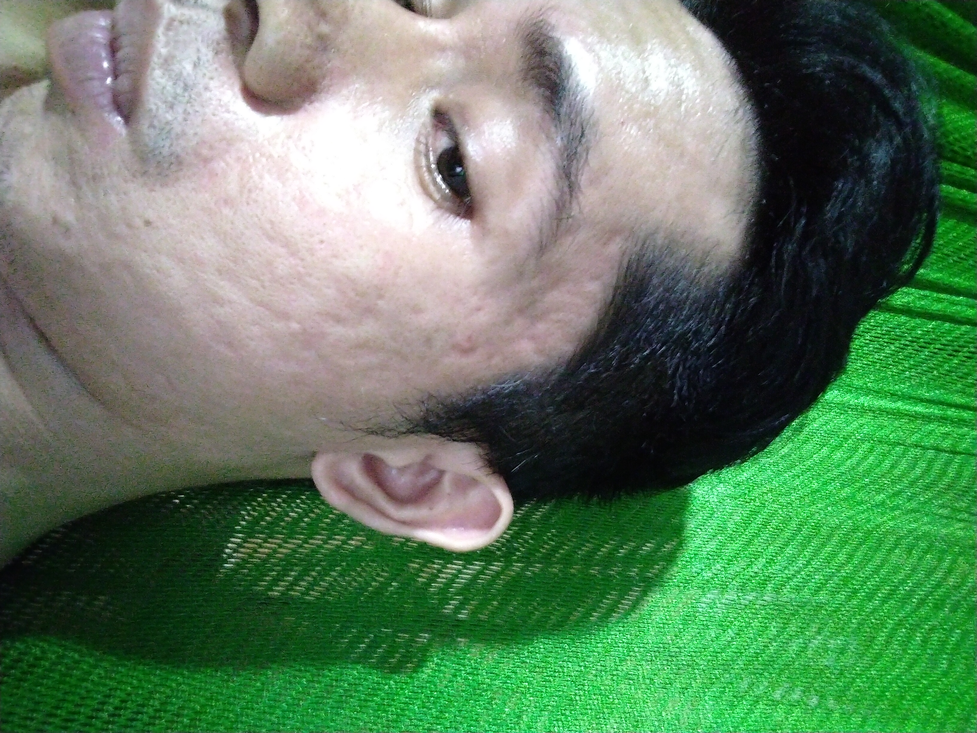 Kem Hỗ Trợ Cải Thiện Sẹo Lồi Strataderm Gel Thụy Sĩ - Hiệu Quả Cho Sẹo Lâu Năm, An Toàn Cho Người Lớn Và Trẻ Em