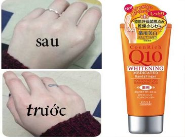 Kem Dưỡng Da Tay Q10 Whitening Medicated - Chăm Sóc Da Tay Mềm Mại, Làm Mờ Vết Chai - Thương Hiệu Kose Nhật Bản 80g