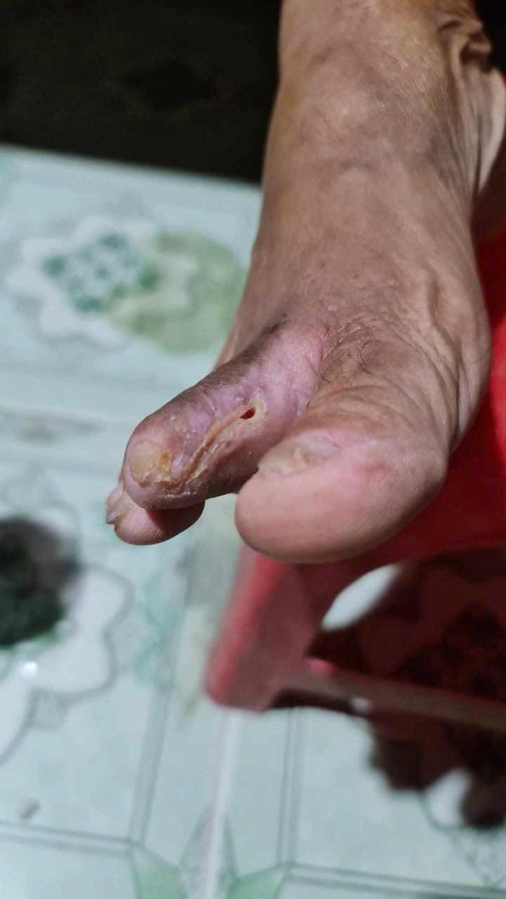 Dung Dịch Vết Thương Hedar - Giảm Đau, Cầm Máu Nhanh, Hỗ Trợ Lành Vết Thương, Phù Hợp Cho Cả Trẻ Nhỏ, Sản Phẩm Y Tế Độc Đáo