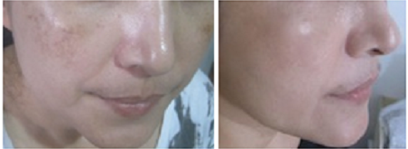 Kem dưỡng trắng phục hồi Sakura Spots Care Brightening Cream