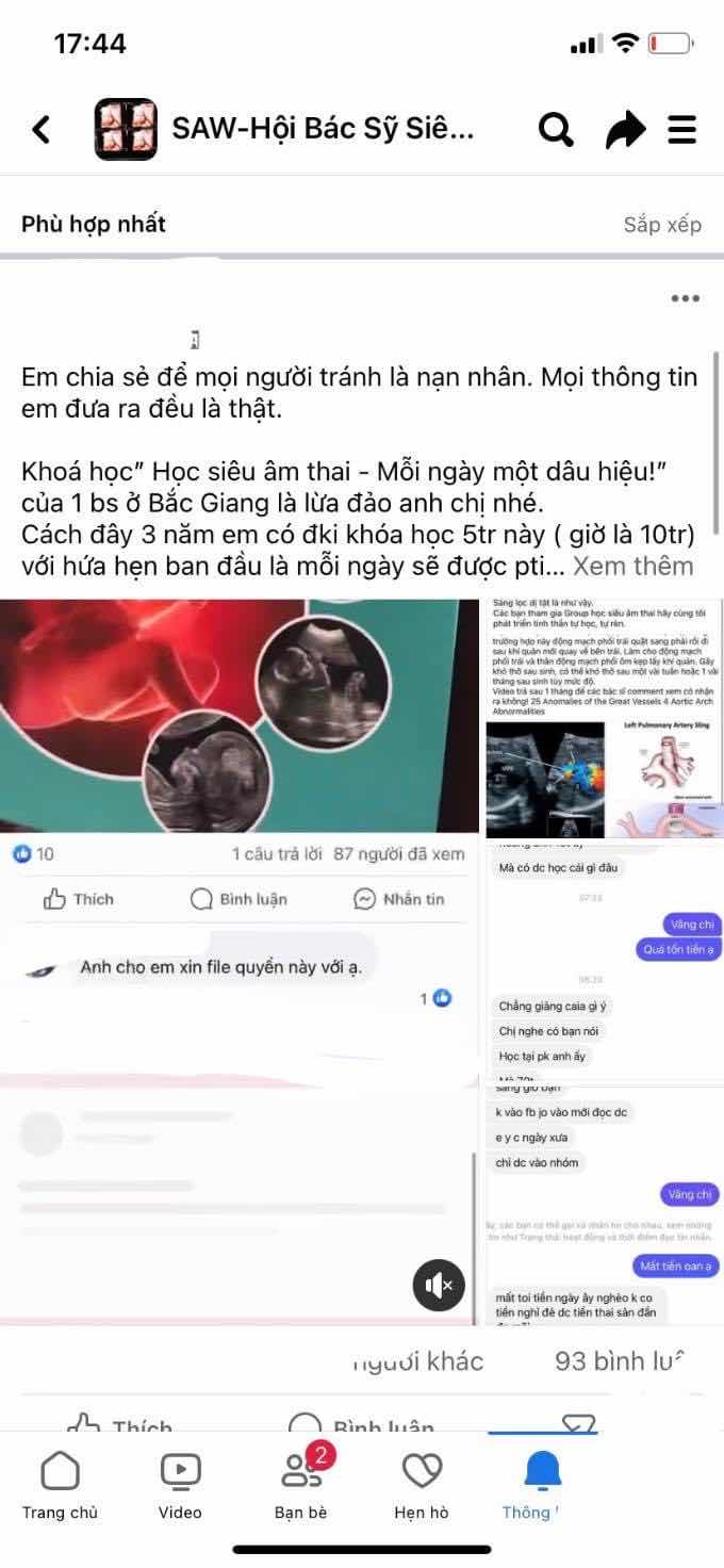 Viên Uống Vitamin Tổng Hợp One A Day Men's Multivitamin Bổ Sung Dinh Dưỡng Chuyên Dành Cho Nam Giới Dưới 50 Tuổi - 300 Viên Chính Hãng Mỹ