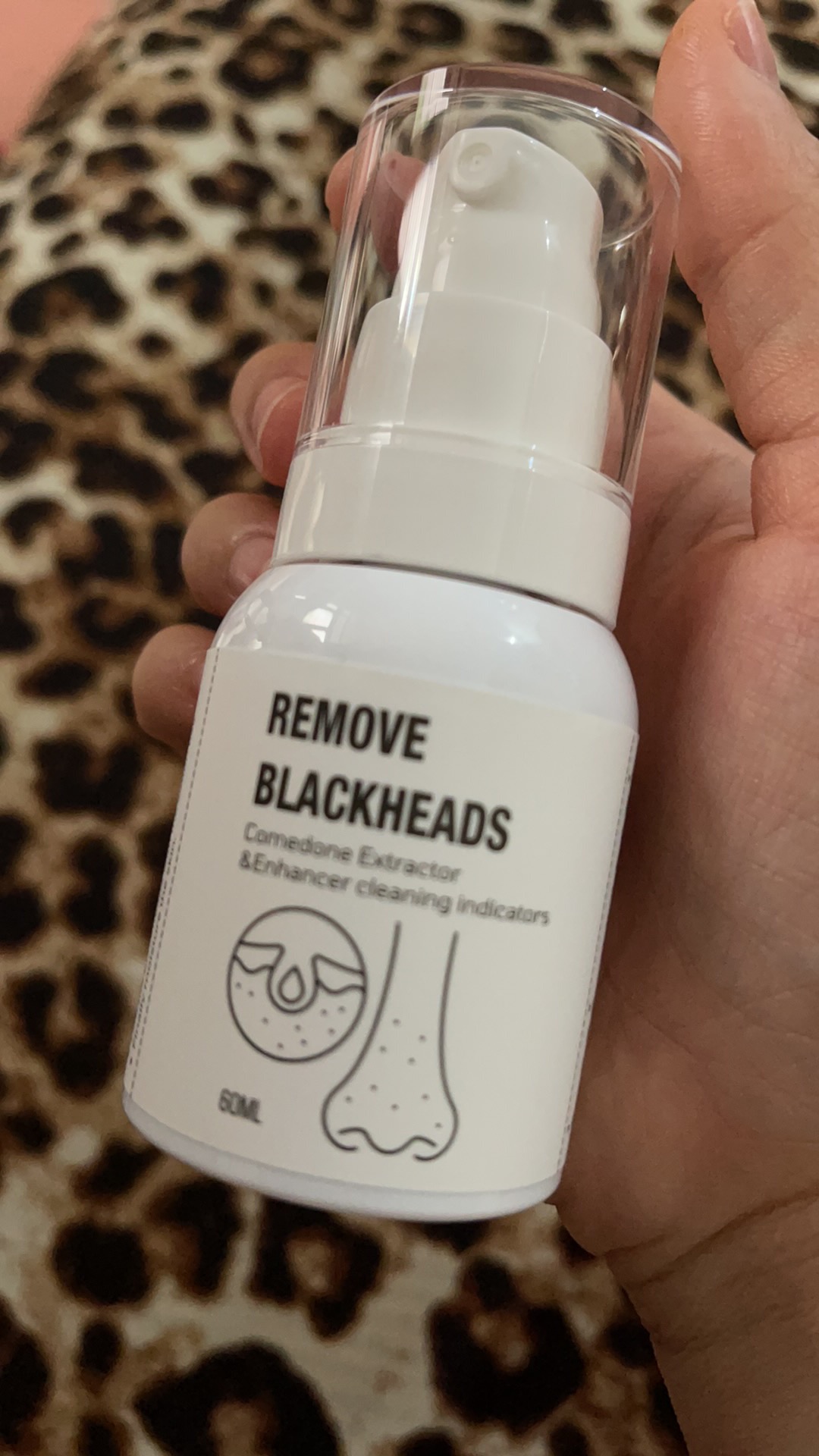 Ủ Mụn Đầu Đen Remove Blackheads 50ml - Chăm Sóc Da Mặt Làm Sạch Sợi Bã Nhờn, Giải Pháp Tận Gốc Cho Da Mụn