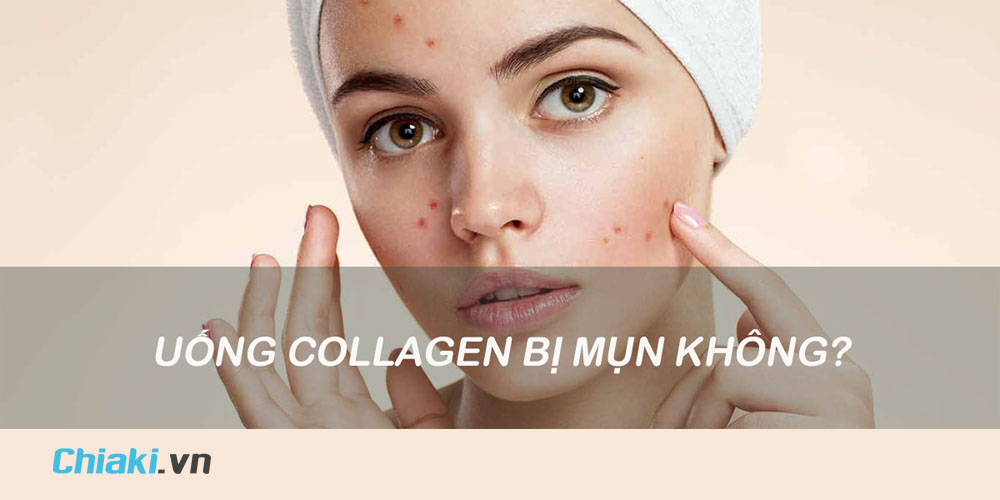 Có phải việc uống collagen Youtheory dẫn đến mụn trên da là do sản phẩm không chất lượng?
