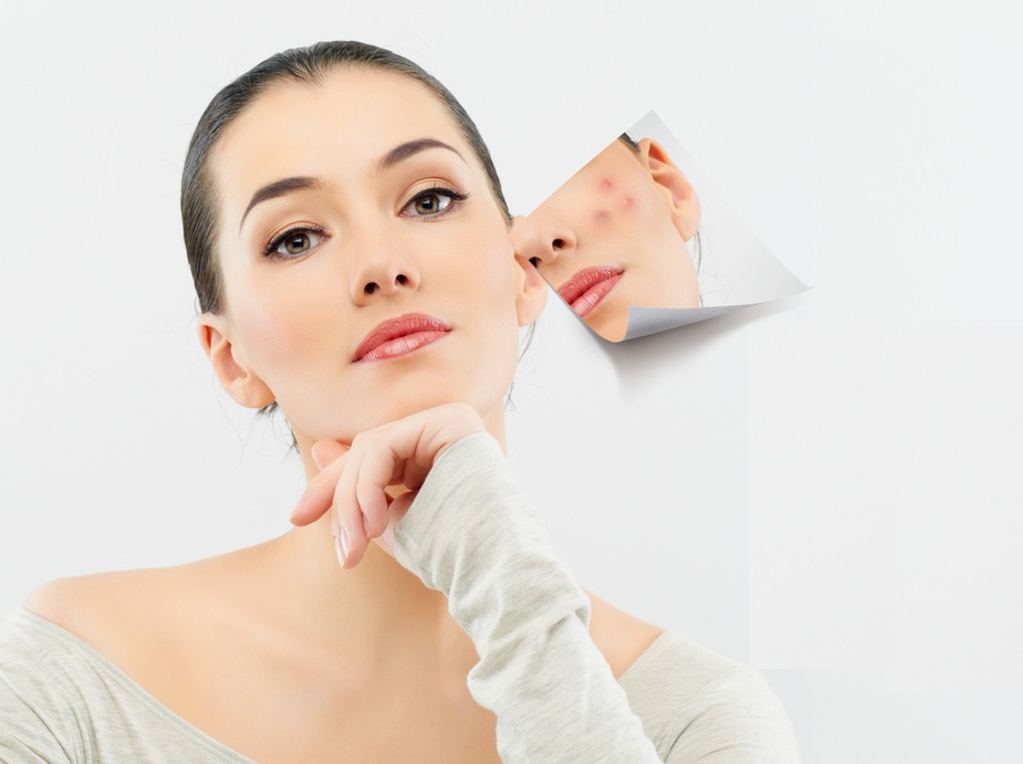 Acnes C10 – Sản phẩm đặc trị vết thâm và sẹo siêu hiệu quả 
