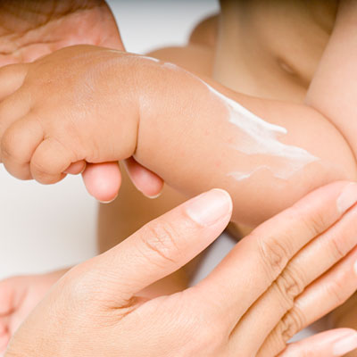 kem dưỡng da chống nẻ chàm sữa cho bé