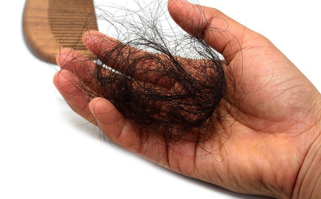 Tại sao tóc nhú chậm chạp, mỏng tanh và gãy rụng nhiều?
