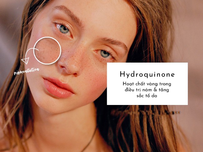 Hydroquinone trong treatment có nghĩa là gì? Một chất làm trắng cực mạnh chuyên về trị nám, tàn nhang