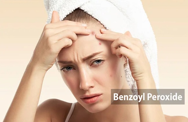 Benzoyl peroxide hỗ trợ điều trị mụn hiệu quả