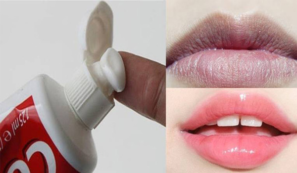 Mẹo trị môi thâm bằng kem đánh răng
