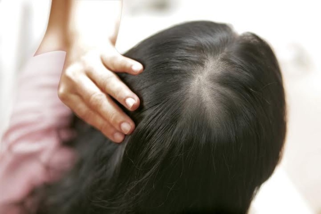 Martiderm Hair System Anti Hair hỗ trợ mọc tóc hiệu quả