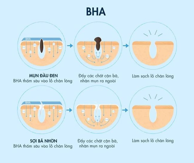 Sản phẩm Treatment BHA