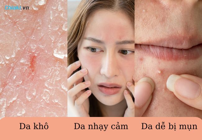 Cách dùng nước tẩy trang đúng cách tại nhà bạn nên biết