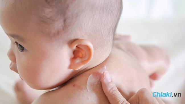 Sử dụng những thành phầm sữa tắm trị rôm sảy cho bé chuyên được sự dụng mang đến bé