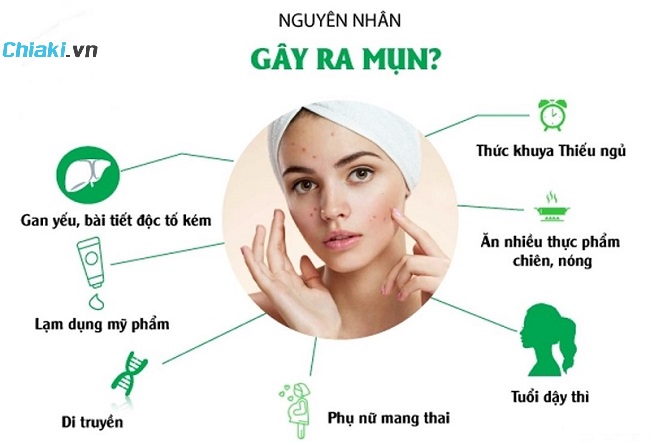 Cách ngăn ngừa mụn trứng cá hiệu quả